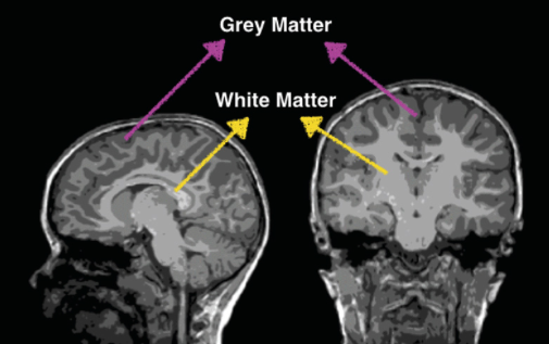 the science of reading - white matter